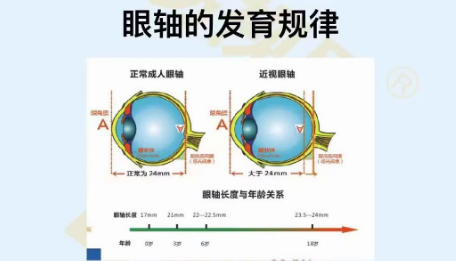 眼軸的發(fā)育規律