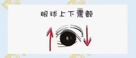 什么是眼球震顫？