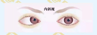 什么是調節性?xún)刃币暎? width=