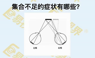 集合不足的癥狀有哪些？